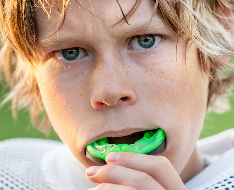 mouth guards in country hills