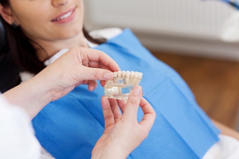 How Do Dentures Stay in Place? NorthPointe Dental Clinic