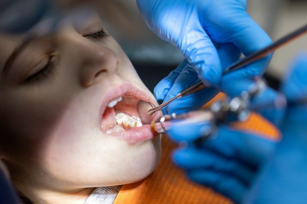 How To Do a Root Canal Treatment for Kids?