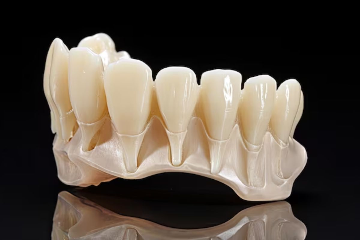 dental bridge restoration replacing missing teeth for improved function and appearance